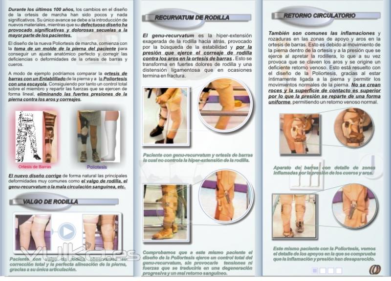 TRIPTICO POLIORTESIS EN FIBRA DE CARBONO