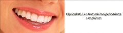 Dental periodent, implante dental