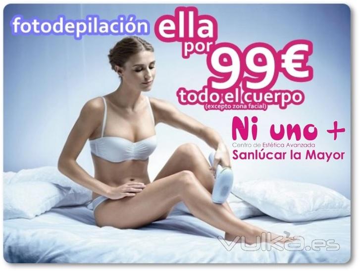 CUERPO ENTERO fotodepilación sólo 99EUR en Ni Uno+ Sanlucar la Mayor