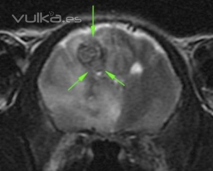 Glioma en cerebro de un perro