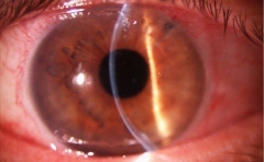 Optica nueva - foto 1