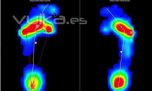 Podologia Deportiva. Podologia La Paz Malaga