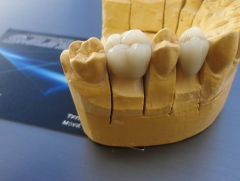 Clinica iess dental - foto 3