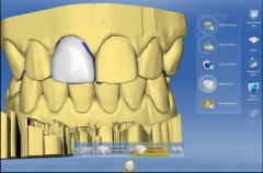 Foto 21 prtesis dentales en Sevilla - Dentista