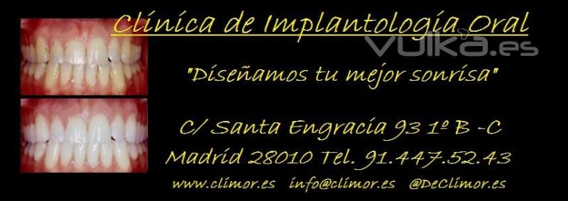 CLINICA DE IMPLANTOLOGIA ORAL