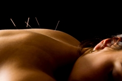 Relajacin y salud con acupuntura