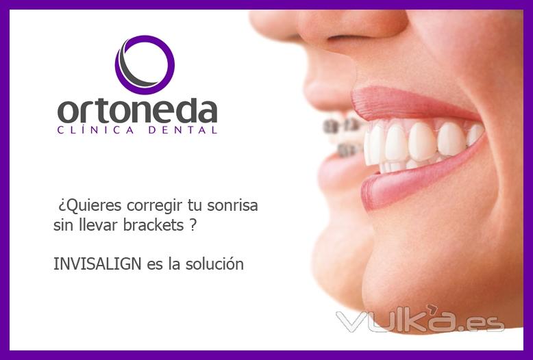 ORTODONCIA INVISIBLE / INVISALIGN