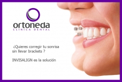 Ortodoncia invisible / invisalign