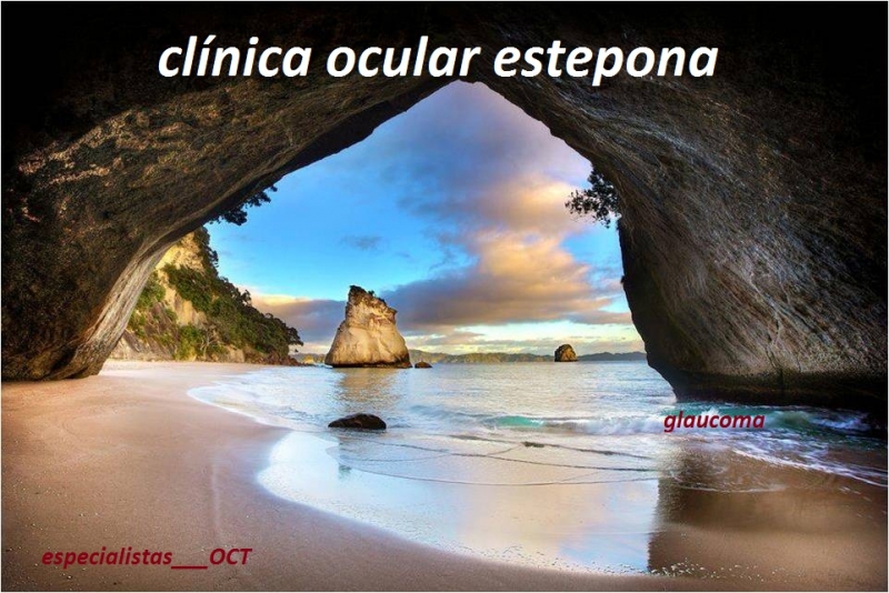 GLAUCOMA y OCT