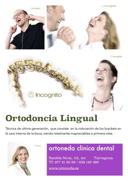 ORTODONCIA LINGUAL