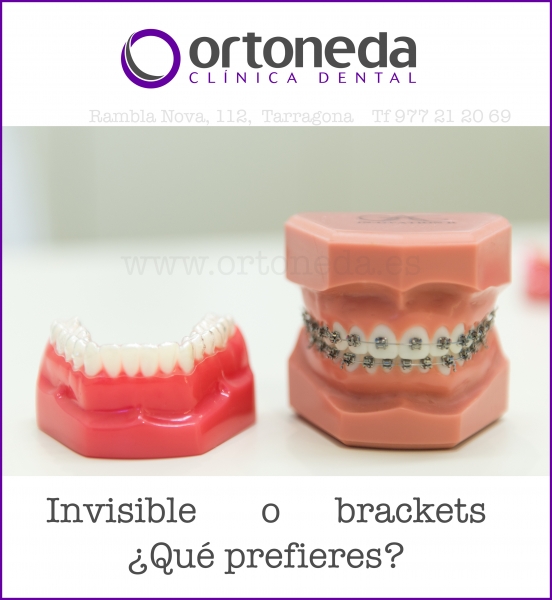 ortodoncia invisible o brackets