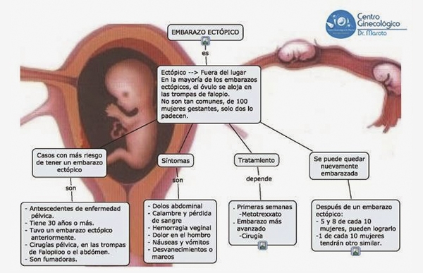 Embarazo Ectpico