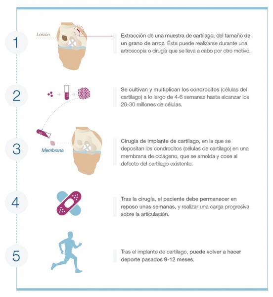 Rotura de ligamentos