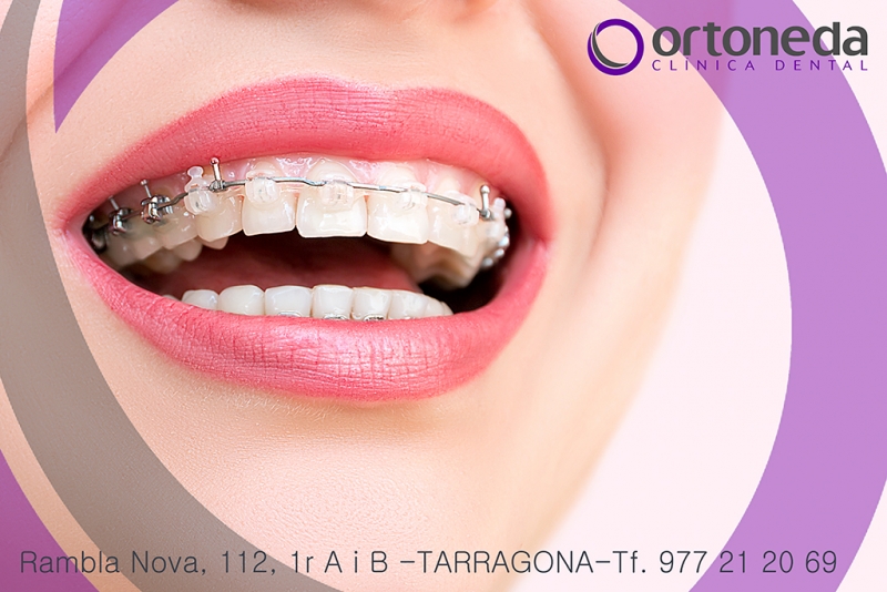 ortodoncia tarragona