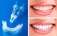 Clinica dental alcala - foto 2