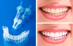 Clinica dental alcala - foto 5