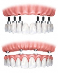 Clnica dental alcal - foto 1