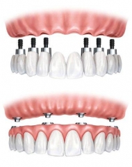Clinica dental alcala - foto 13