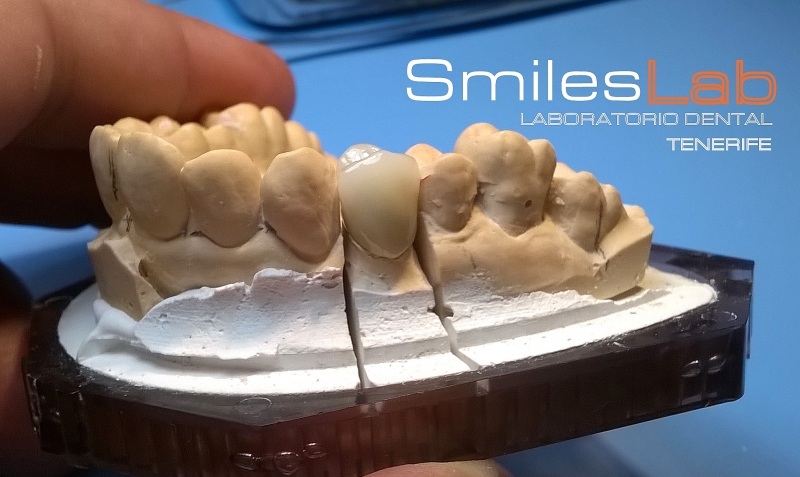 Laboratorio dental Smileslab