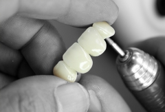 Foto 394 implantología dental - Laboratorio Dental Smileslab