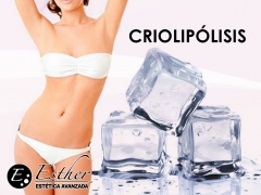 Criolipolisis en alicante