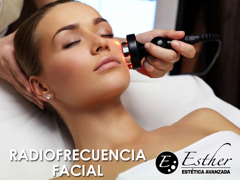 RadioFrecuencia Facial en Alicante