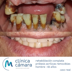 Foto 28 clnicas dentales, odontlogos y dentistas en Granada - Clnica Cmara Granada