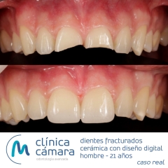 Foto 24 clnicas dentales, odontlogos y dentistas en Granada - Clnica Cmara Granada