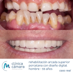 Foto 21 clnicas dentales, odontlogos y dentistas en Granada - Clnica Cmara Granada