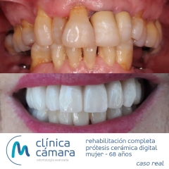 Foto 29 clnicas dentales, odontlogos y dentistas en Granada - Clnica Cmara Granada