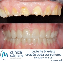 Foto 18 clnicas dentales, odontlogos y dentistas en Granada - Clnica Cmara Granada