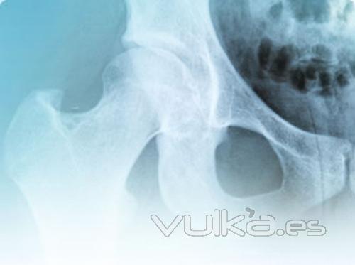 rea de Medicina Osteoarticular