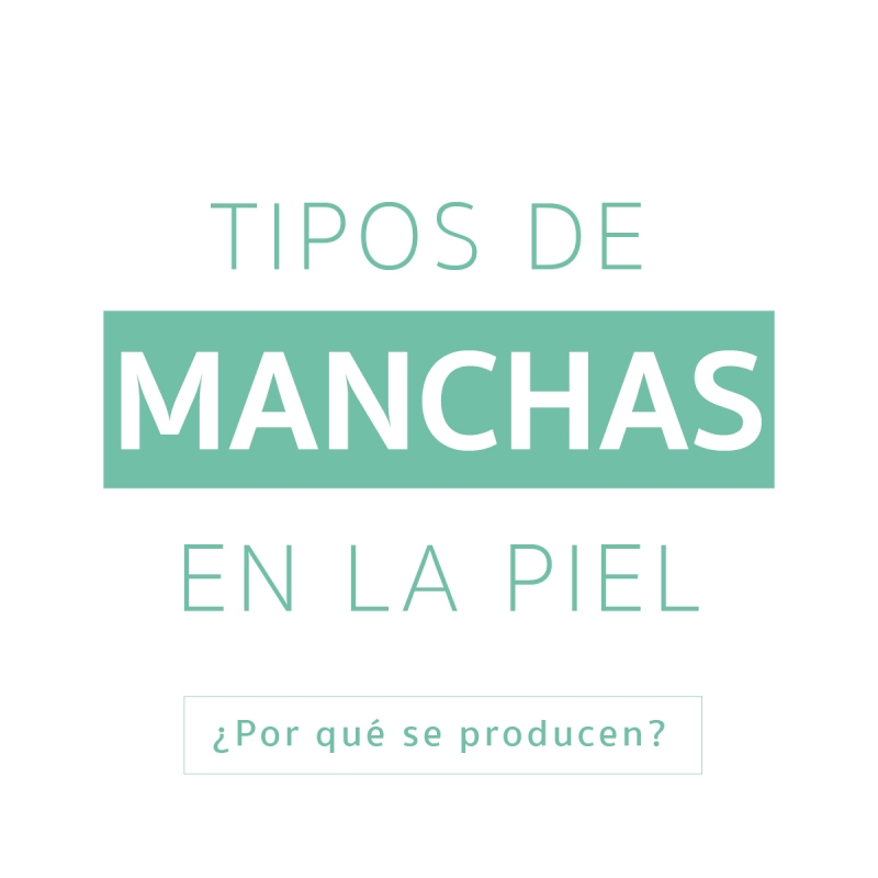 IG: Ecofynder - Tipos de manchas en la piel