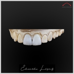 Foto 332 protésicos dentales - Laboratorio Dental Eduardo Lopez
