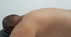 Acupuntura eva costa - acupuntor ibiza - acupuncturist ibiza - acupuntura ibiza - acupuncture ibiza