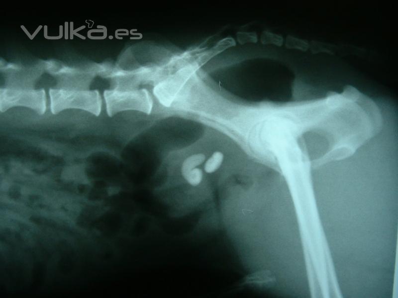 diagnóstico por imagen - radiografía
