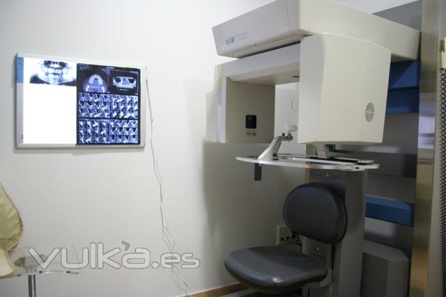 Scanner dental i-CAT