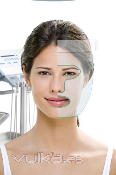 Tratamiento estelar para rejuvenecimiento facial, manchas, acn...