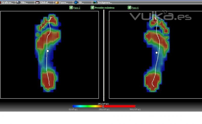 Valoracin postural dinmica con ejes de movimiento