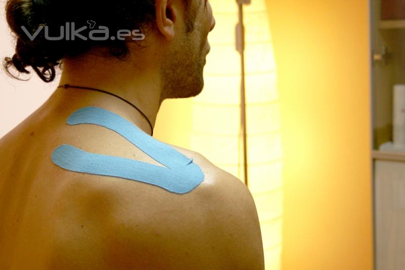 Kinesiotaping