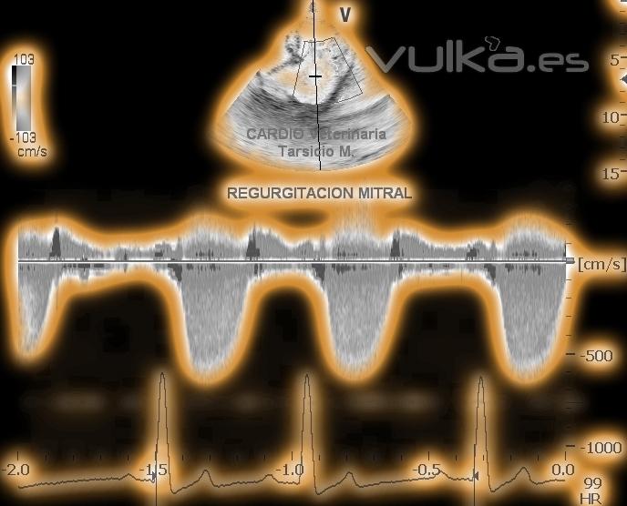 ECOCARDIOGRAFA DOPPLER CONTINUO REGURGITACIN MITRAL , SINCRONIZADO ECG