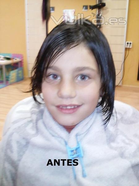 ANTES