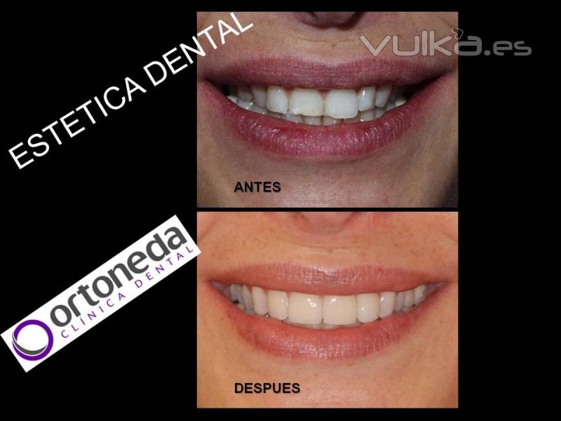 Esttica Dental.