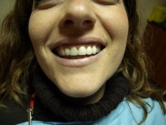 Calitecno dental - foto 5