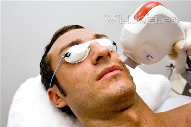 Mesoterapia Facial