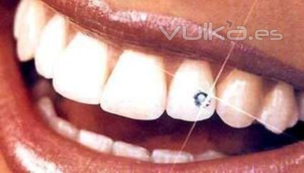 PIERCING O BRILLANTE DENTAL