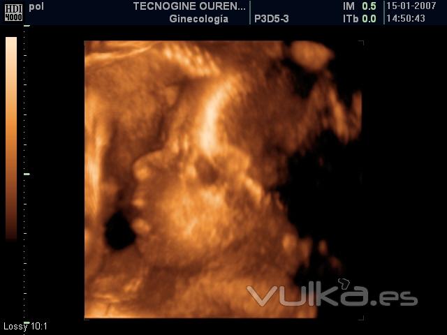 3D, tecnogine
