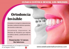 Ortodoncia estetica,invisible