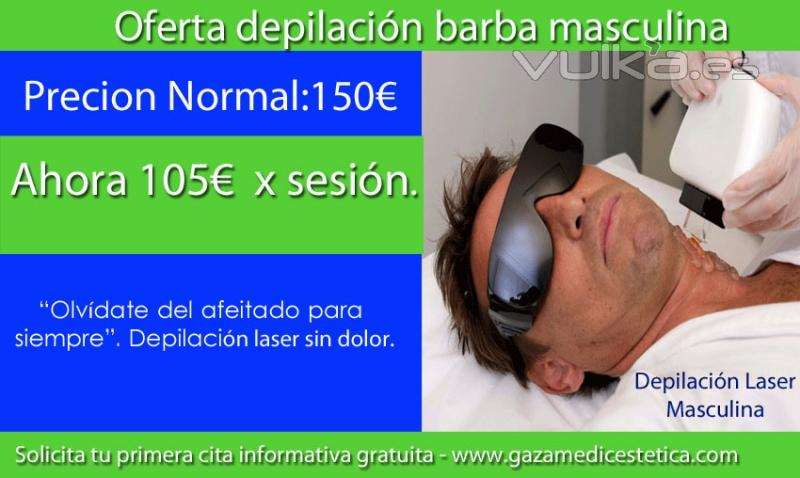 Depilacin laser masculina - Barba , por el mes de diciembre .